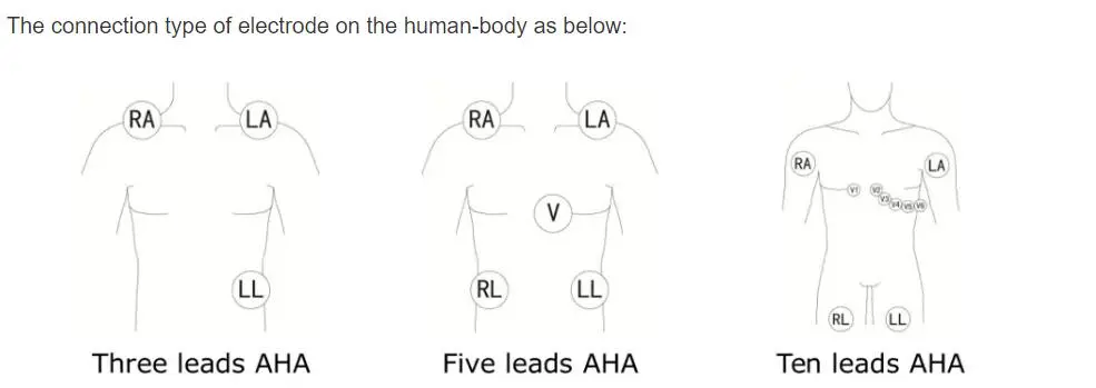 5 أسلاك الرصاص ECG 5-ليد فيليبس ديجيتراك زائد 24 ساعة هولتر 3100A ، 5-الرصاص ، Snap